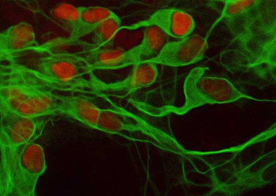 Neurônios motores, justamente o tipo de célula com problemas em pacientes com esclerose lateral amiotrófica | Kit Rodolfa e John Dimos/Universidade Harvard