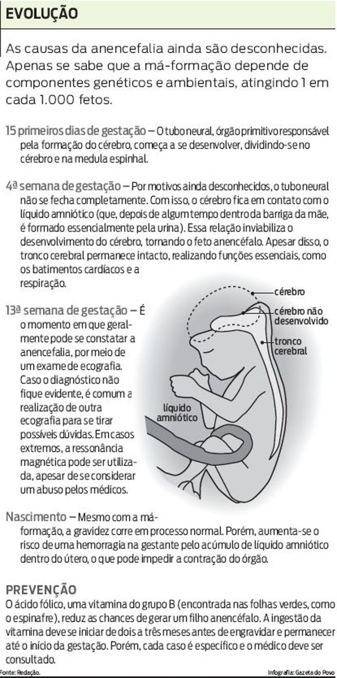 Veja como acontece a anencefalia | 