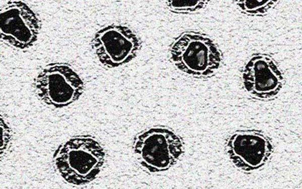 Imagem microscópica mostra vírus HIV no plasma sanguíneo | Reprodução G1