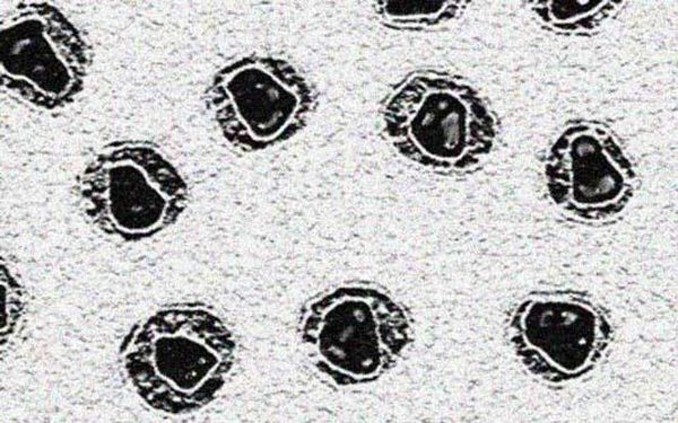 Imagem microscópica mostra vírus HIV no plasma sanguíneo | Reprodução G1