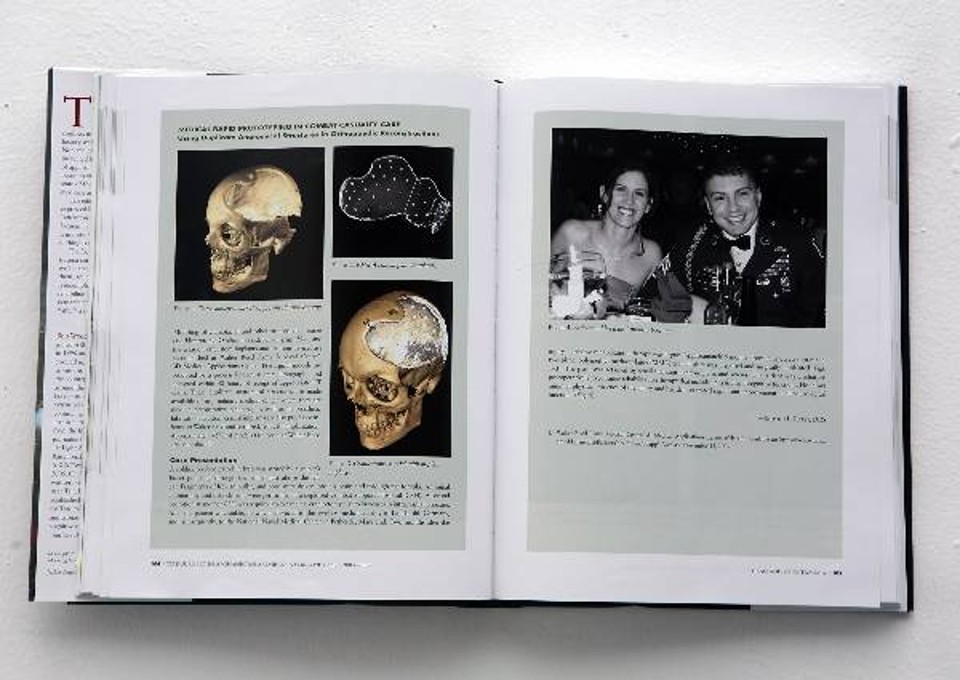 Livro do Exército americano mostra cirurgias feitas em áreas de guerra | Reprodução: The New York Times