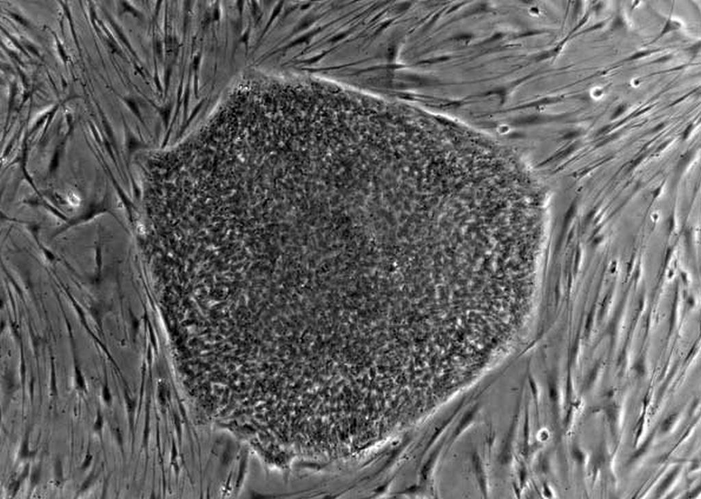Células-tronco embrionárias: o desafio das adultas é conseguir o mesmo desempenho | Reprodução