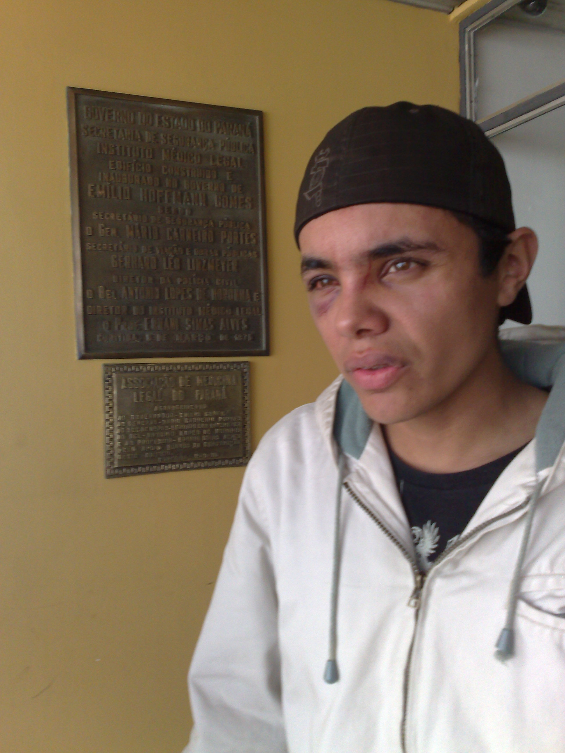 Imagem de Antônio Aristeu Chagas Neto no dia posterior em que diz ter sofrido agressão no bar Santa Fé | João Varella/Gazeta do Povo