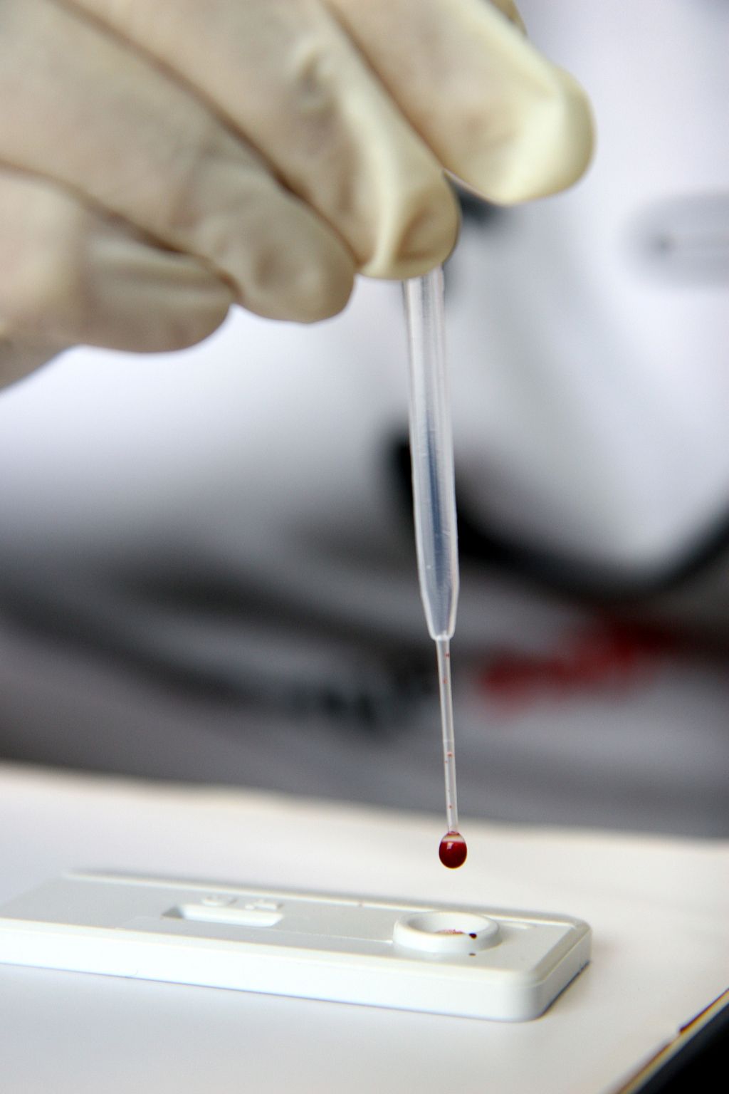 Doença estaria relacionada com o surgimento das cidades modernas | Henry Milléo/Gazeta do Povo