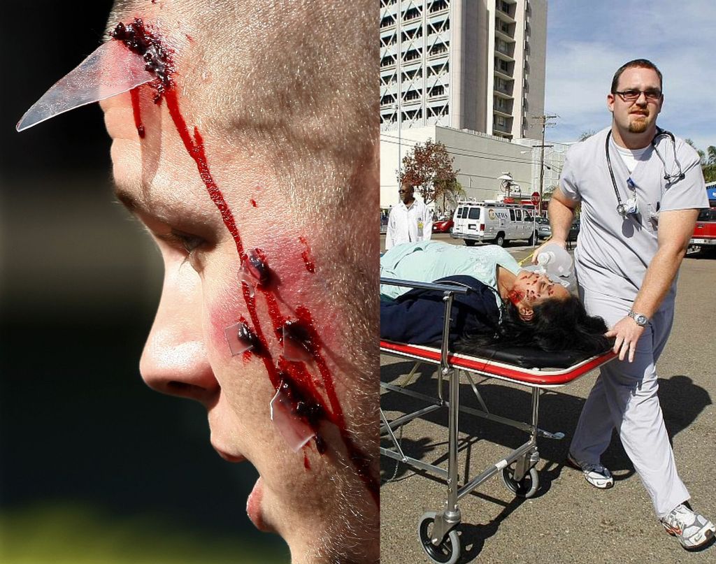 Rapaz simula ter sido atingido por estilhaços de vidro no rosto (esq.). Enquanto figurante é socorrida por equipe médica (dir.) | Mike Blake / Reuters