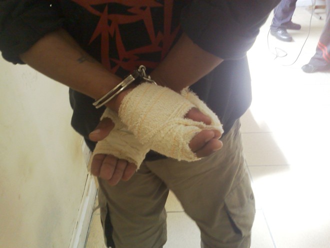 Renato Serra teve as mão enfaixadas em razão do ataque da canina que tentou roubar | 