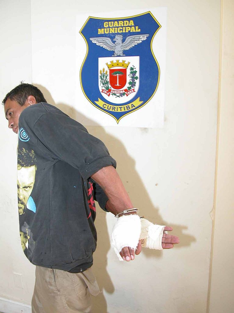 Renato Serra precisou ter as mãos enfaixadas por causa do ataque da cobra | Fotos: Osvaldo Ribeiro/SESP