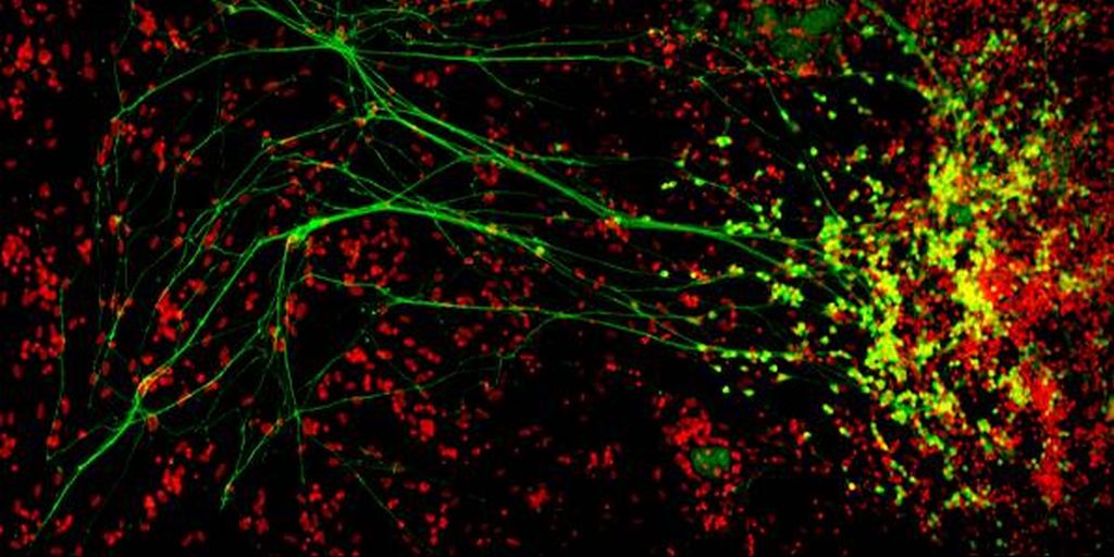 Em vermelho, os núcleos das células; em verde, os neurônios motores se comportando como na doença | Carol Marchetto/Divulgação
