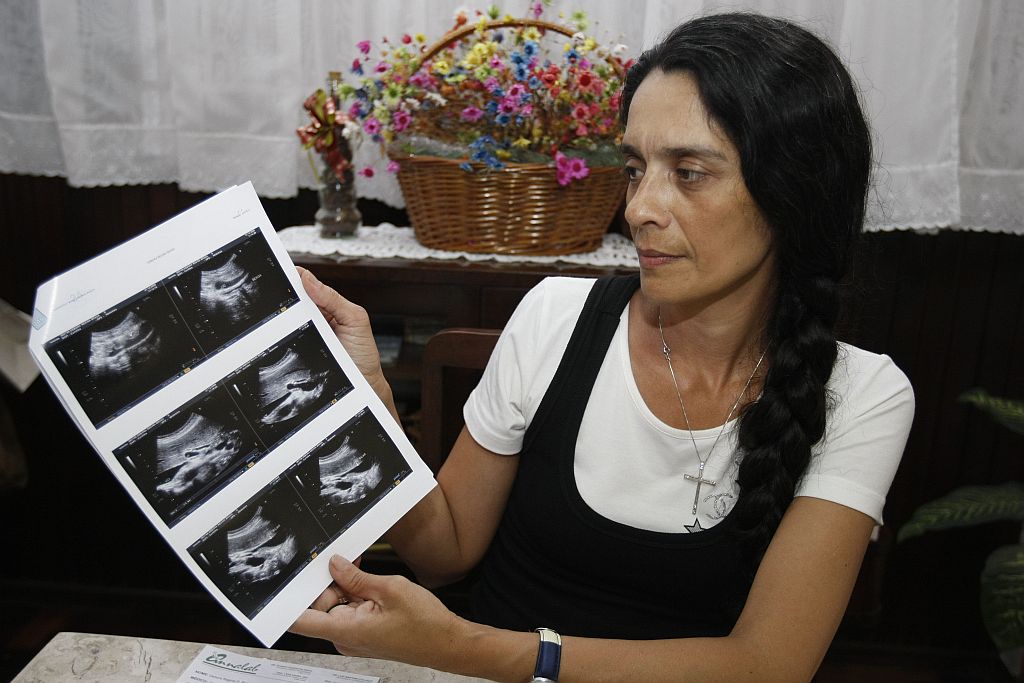 A psicóloga Débora Braga sente-se finalmente livre da operadora de saúde, cujo plano não cobriu boa parte dos exames. | Pedro Serápio/Gazeta do Povo