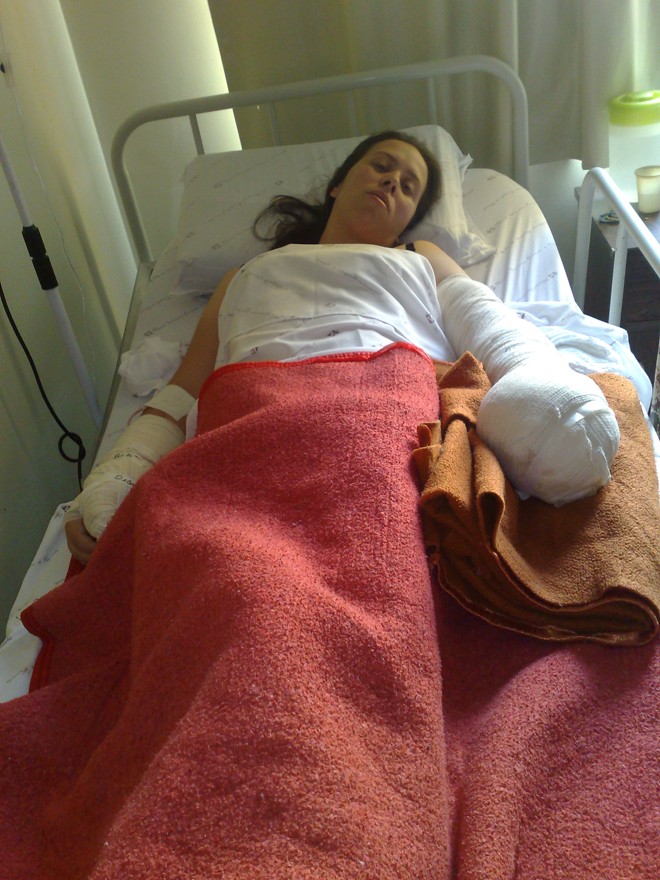 Patrícia Sodré Saleski, 27 anos, teve queimaduras nas mãos |