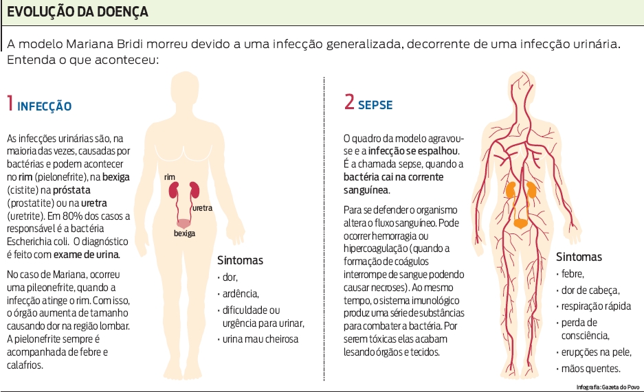 Entenda o que aconteceu com a modelo que morreu devido a uma infecção generalizada |