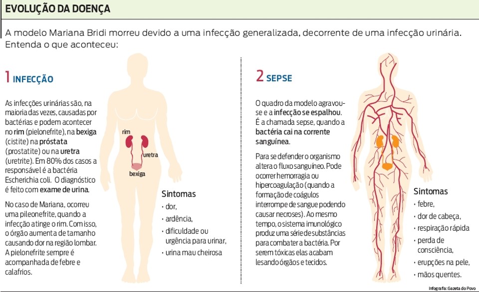 250 mil morrem todo ano por complicações da sepse