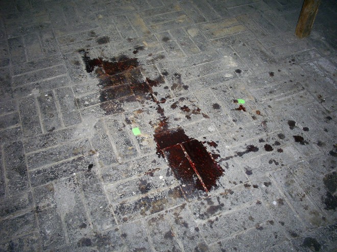 Manchas de sangue cenográfico usado nas gravações de 400contra1 | 