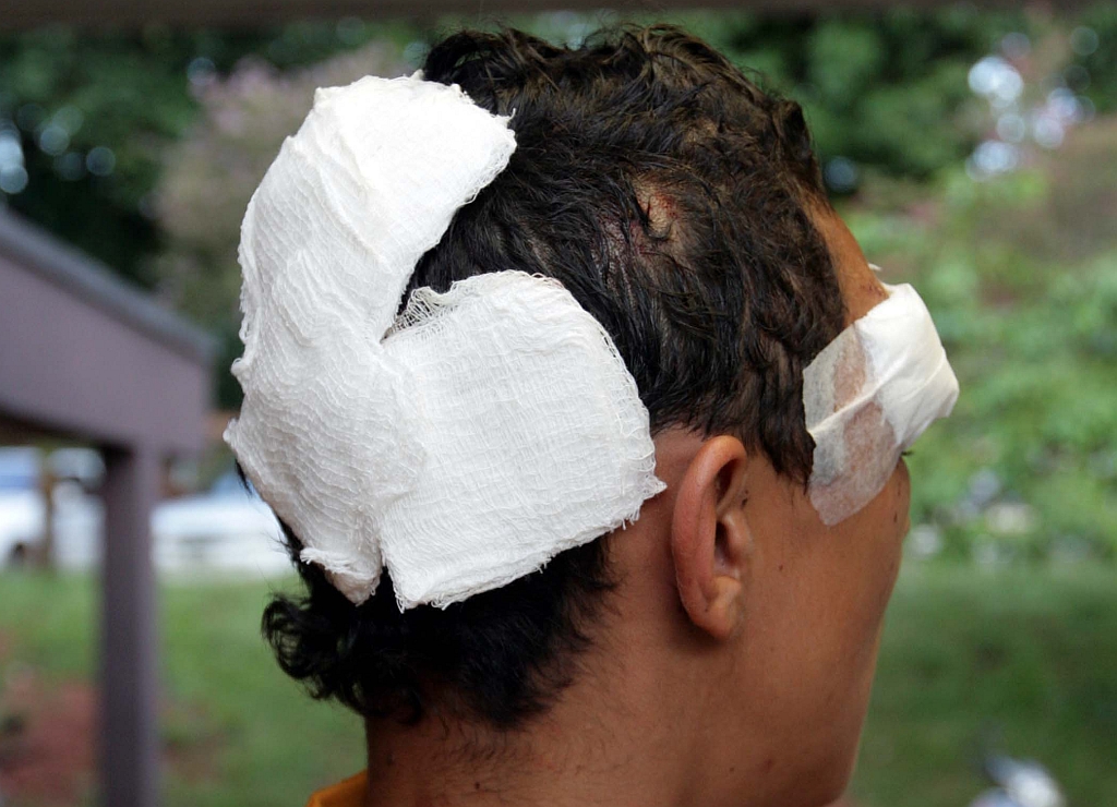 Rapaz de 17 anos agredido por policiais em Foz do Iguaçu: 84 pontos | Christian Rizzi/Gazeta do Povo