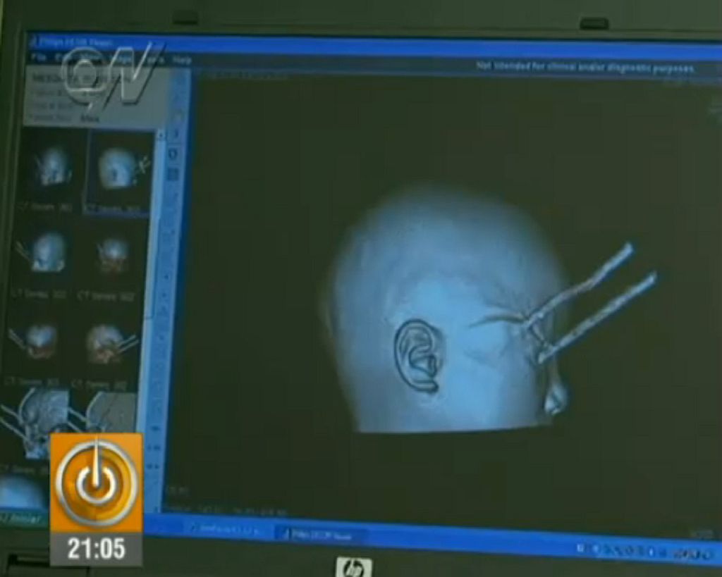 Radiografia do garoto: risco de perda da visão está afastado | Reprodução