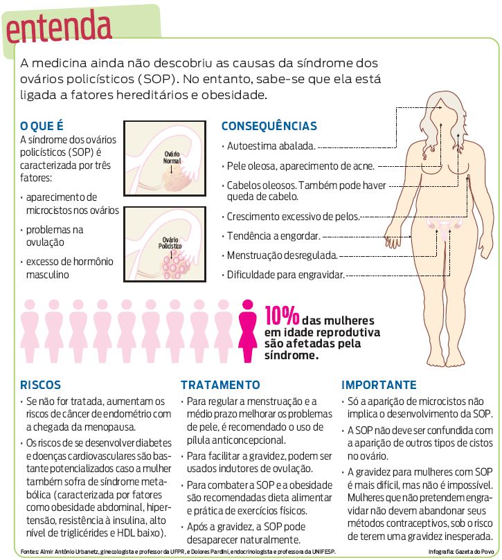 Saiba mais sobre a síndrome dos ovários policísticos |