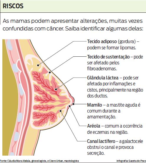 Saiba identificar algumas alterações das mamas |