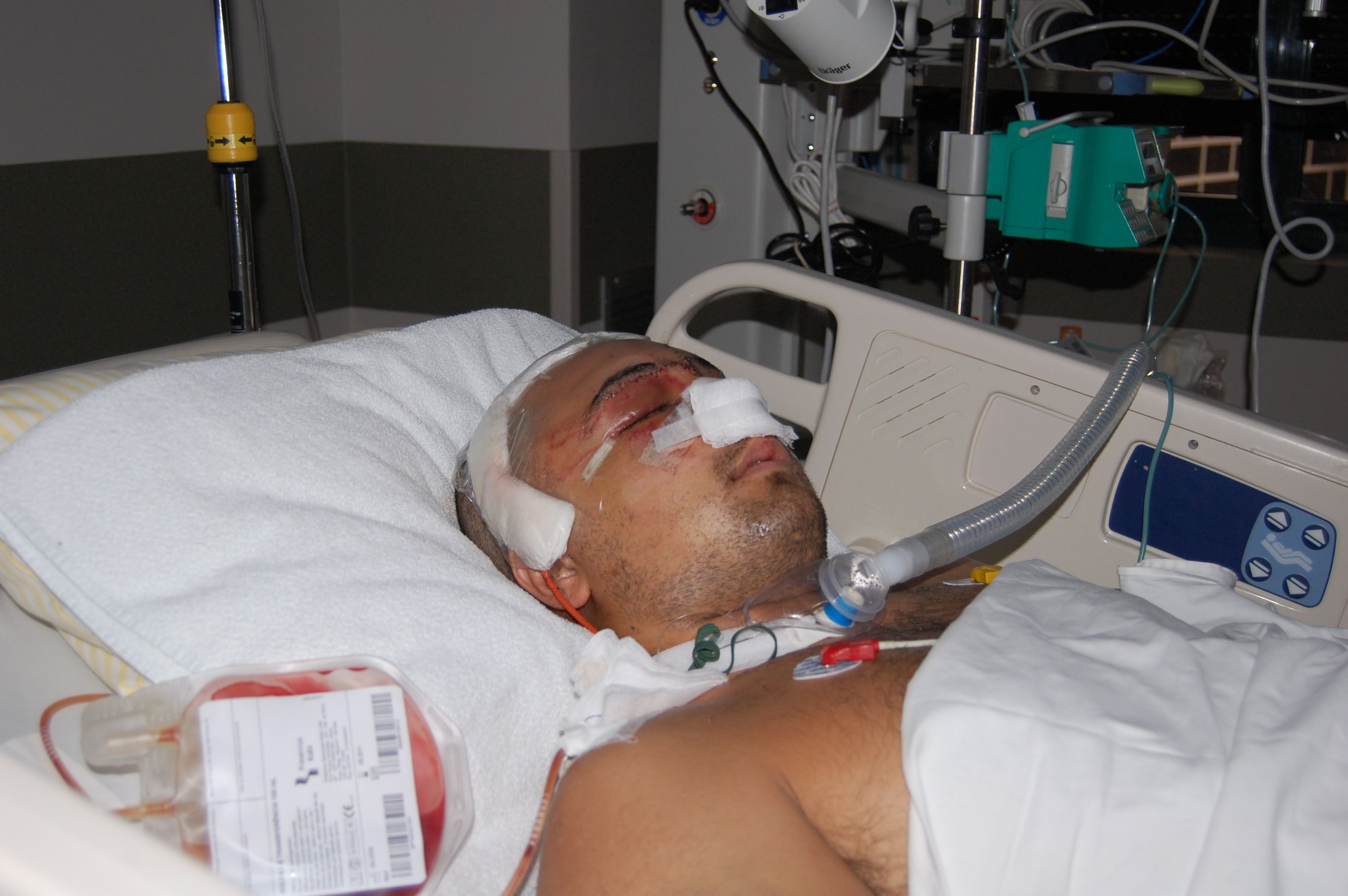 Deputado já deixou UTI e está em um quarto do HospitalAlbert Einstein, emSão Paulo | Divulgação