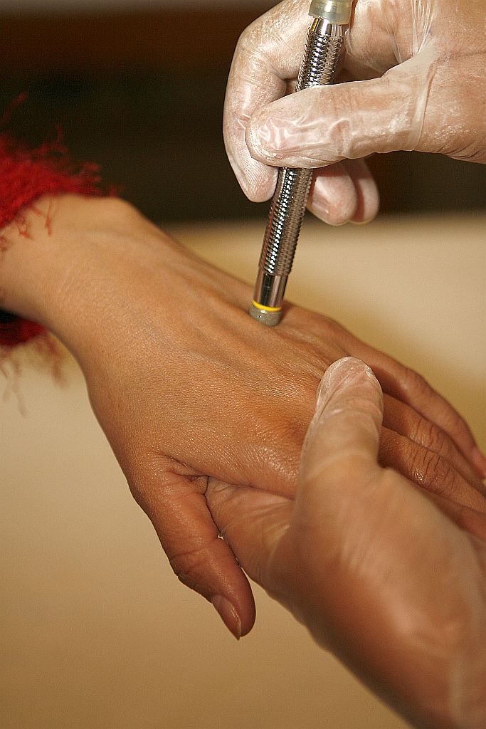 Peeling de diamante é uma das técnicas muito usadas para suavizar as linhas da pele | Hedeson Alves/Gazeta do Povo