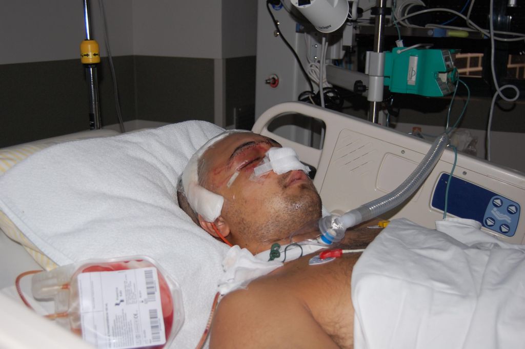 Carli Filho na UTI, após cirurgia. Foto foi divulgada pela família | Paulo Esteche/Assessoria de imprensa de Carli Filho