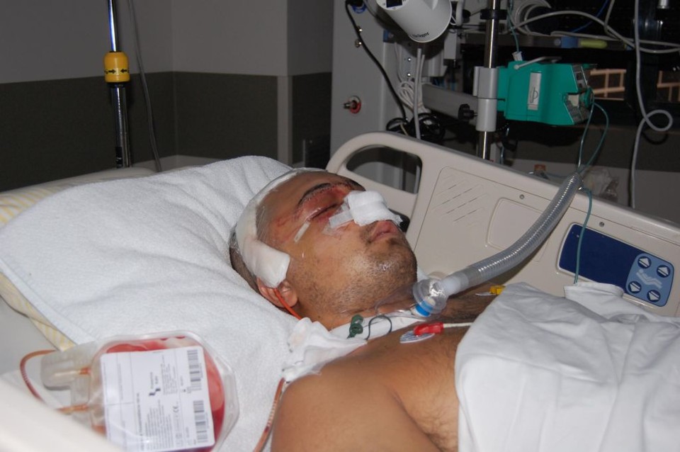 Carli Filho na UTI, após cirurgia. Foto foi divulgada pela família | Paulo Esteche/Assessoria de imprensa de Carli Filho