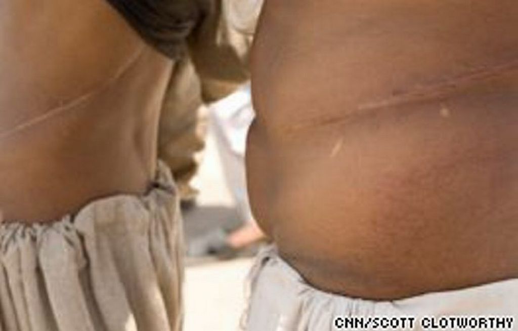 Paquistaneses vendem rins para saldar dívidas | Reprodução / CNN