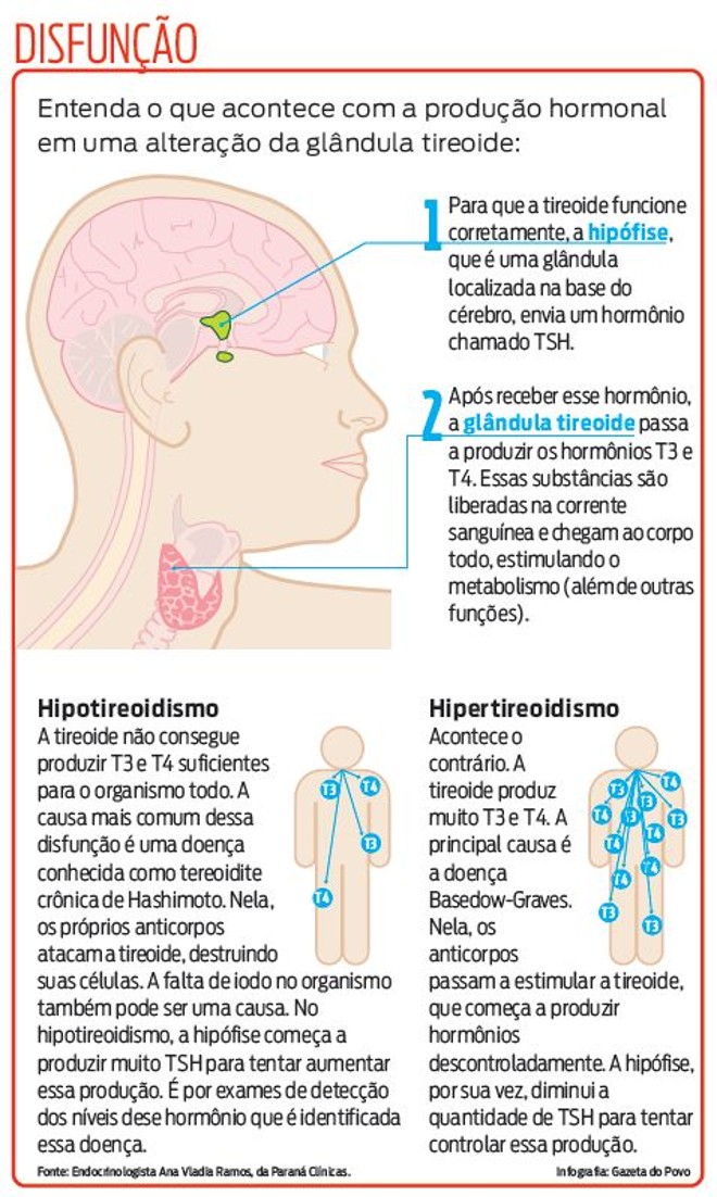 Entenda o que acontece com a produção hormonal com alteração da tireoide |