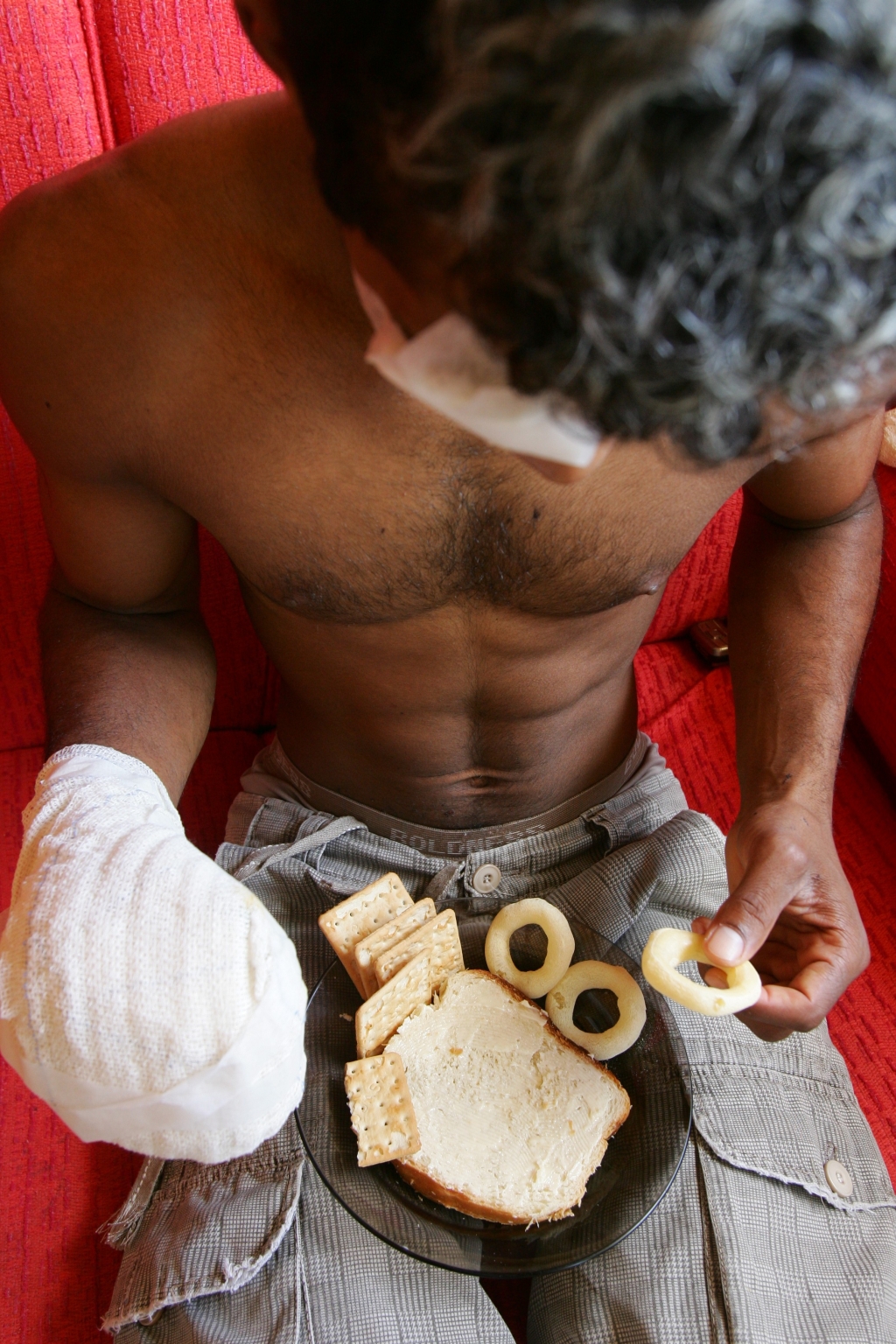 Manoel (nome fictício) se acidentou no Natal e perdeu parte de três dedos | Daniel Castellano/Gazeta do Povo