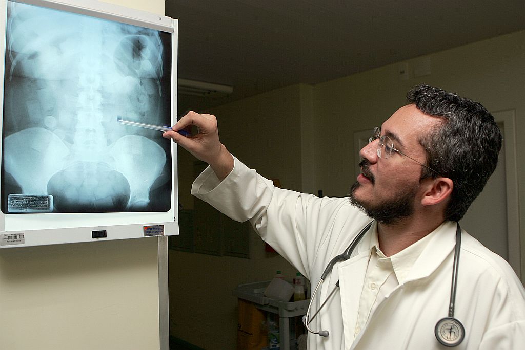 O clínico-geral Alessandro Machado mostra raio X: exame é feito em passageiros suspeitos | Christian Rizzi/Gazeta do Povo