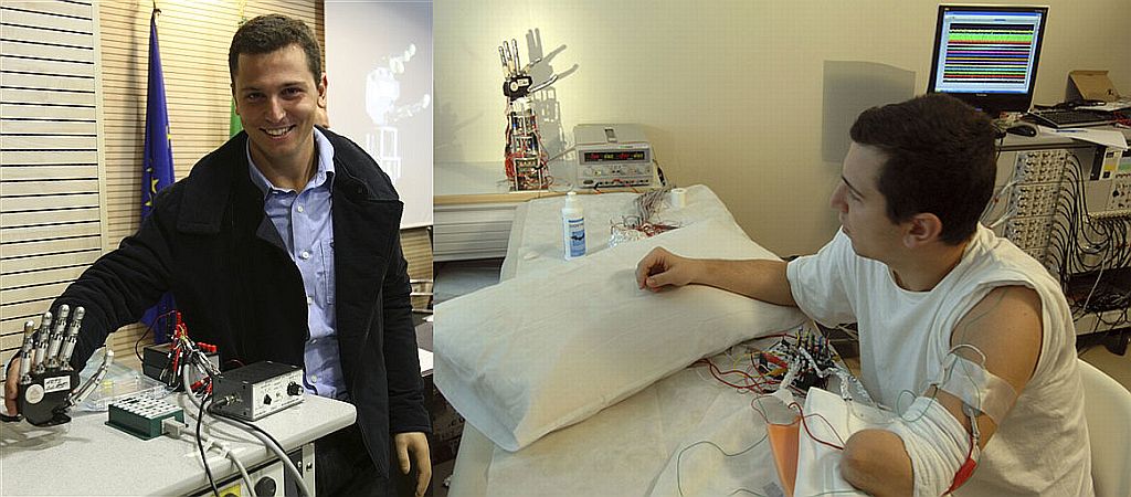 Pierpaolo com a mão biônica (ontem) e durante os testes (2008), em que controlou a mão a distância: possibilidade de usá-la no futuro | Campus Biomedico de Roma