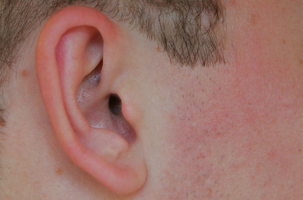 A otite externa é o problema mais comum dos ouvidos no verão | Pedro Serápio/Gazeta do Povo