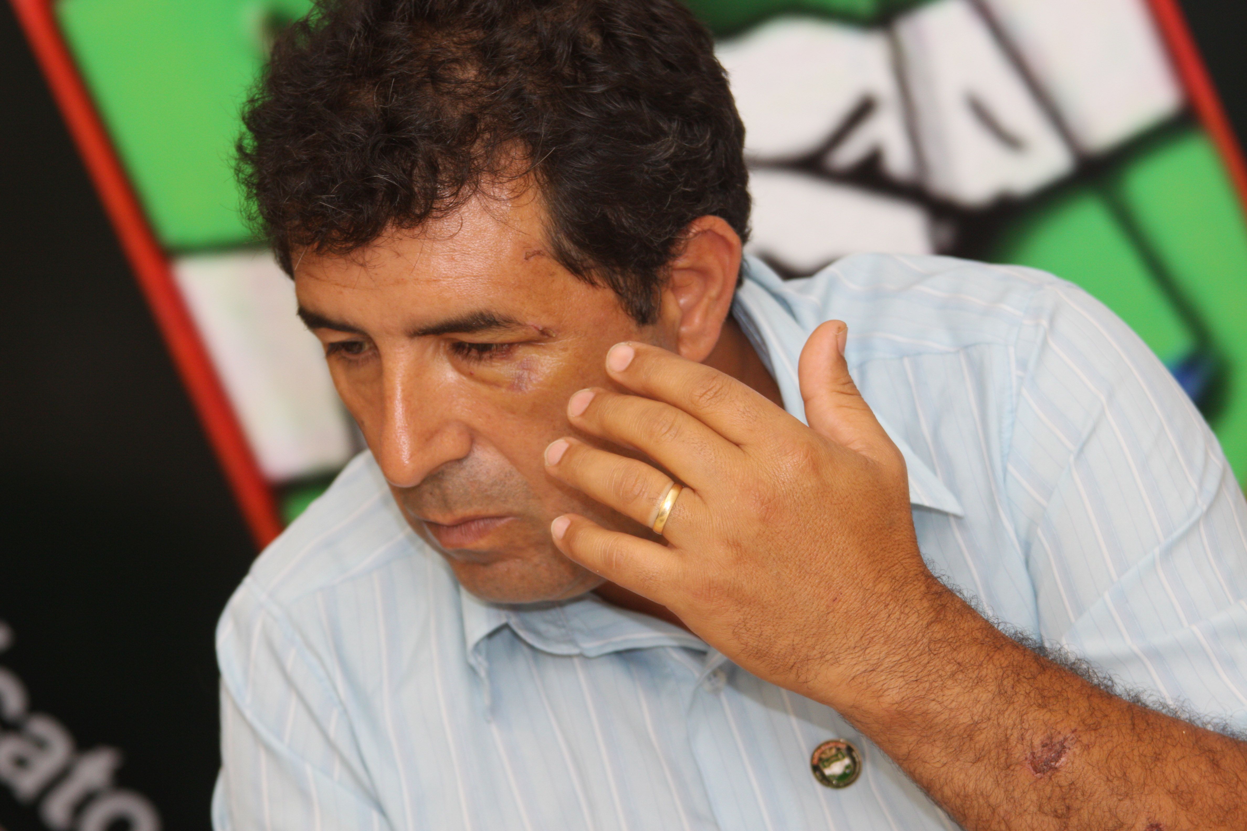 Os agentes foram agredidos com pedaços de pau e barras de ferro | Giuliano Gomes - Agência de Notícias Gazeta do Povo