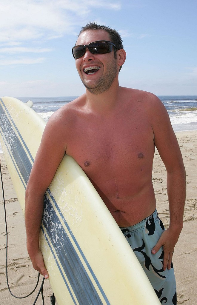 Duas horas surfando sem proteção debaixo de mormaço deixaram vermelho o administrador de empresas Fábio Murilo Bottene, de 35 anos. Agora, o curitibano não sai de casa sem ter aplicado filtro protetor 30 minutos antes |