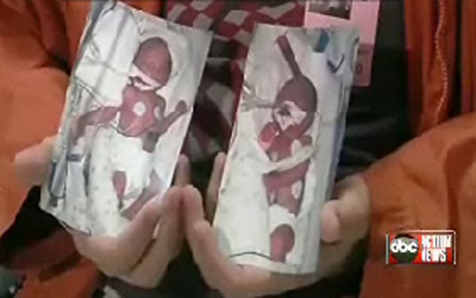 Gêmeos nascidos em anos diferentes, nos EUA | Reprodução/ABC