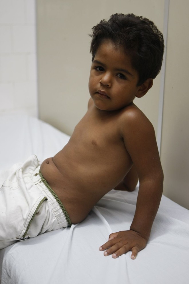 Restrições: Victor, de 3 anos, não pode comer frutas e agora desenvolveu urticária |