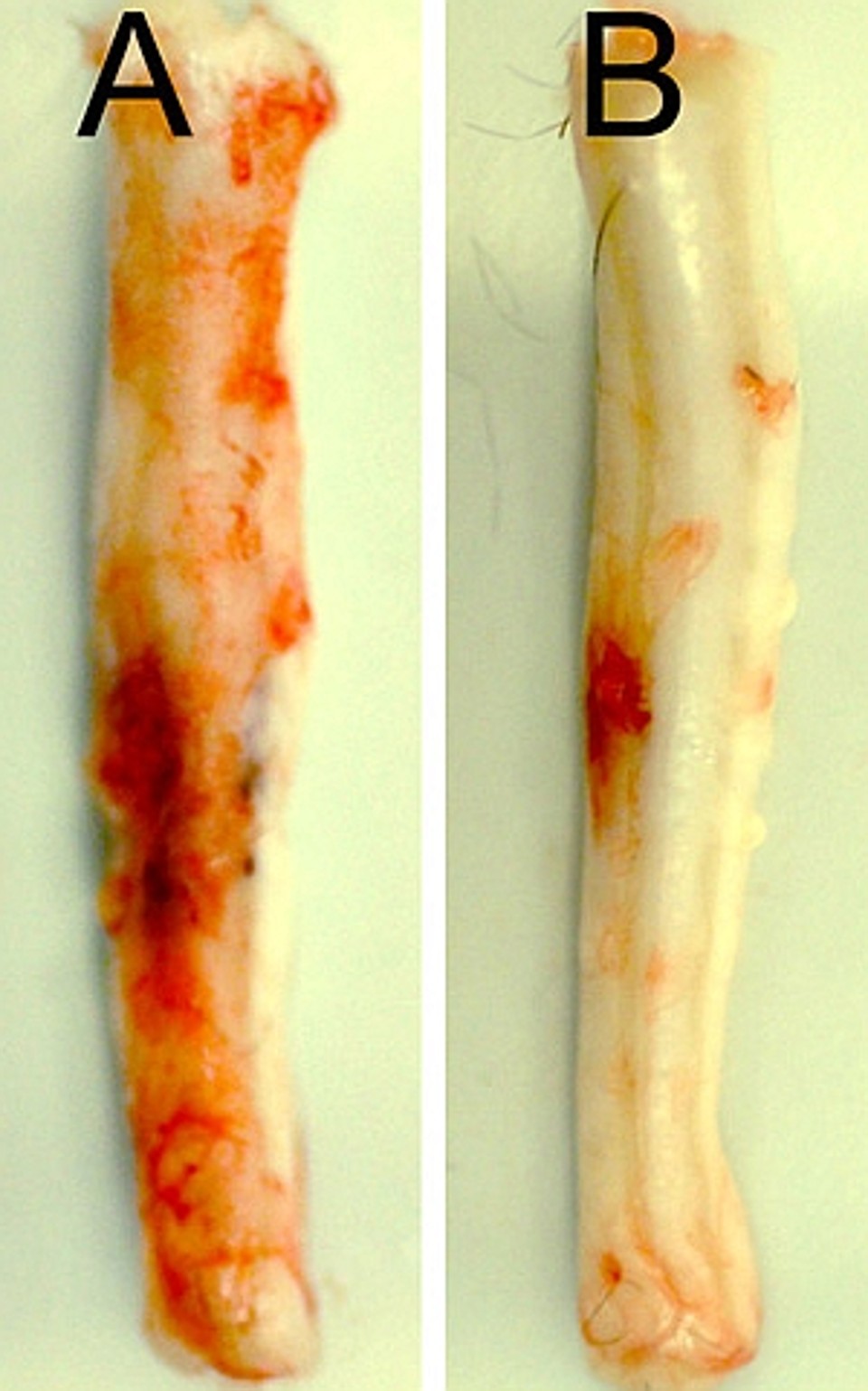 Medula espinhal de ratos 24 horas após ferimento cervical: a cobaia B recebeu tratamento para silenciar o gene Abcc8, com uma notável redução de hemorragia | Cortesia de J. Marc Simard