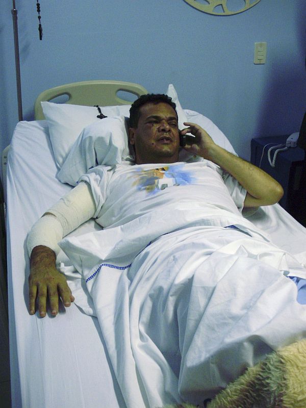 O senador Roberto Acevedo, que foi atingido por dois tiros: represália | Daniel Figueredo/Reuters