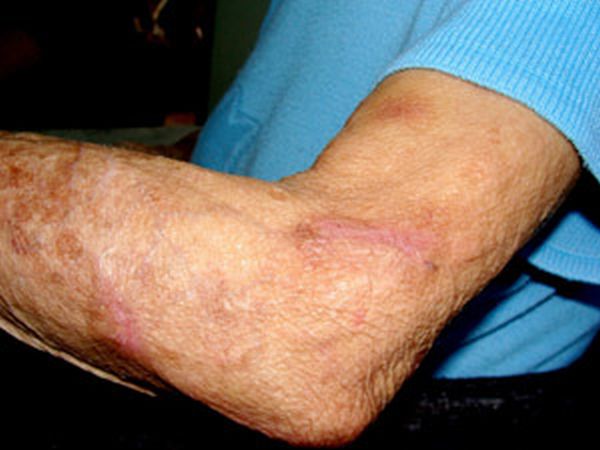 Idosa apresentou ferimentos nos braços | Divulgação / Polícia Civil do Paraná