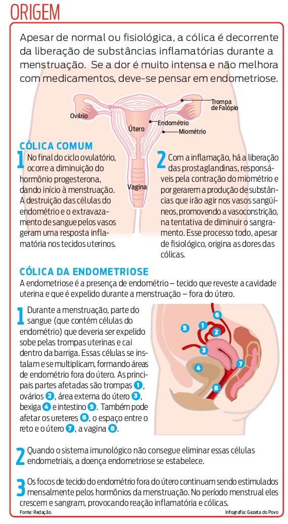 Veja mais dicas sobre a endometriose |