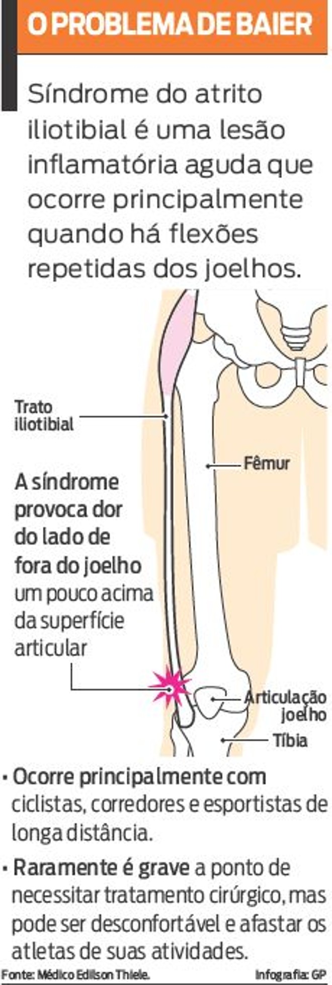 Saiba mais sobre a síndrome do atrito iliotibial | 