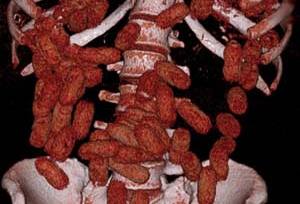 Imagem ilustrativa do suspeito | Divulgação PF