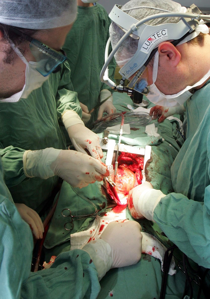 SUS chega a pagar R$ 940 por operação de coração. Valor acaba sendo dividido por até seis profissionais | Daniel Castellano/Gazeta do Povo