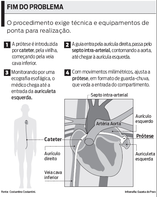 Confira: procedimento exige técnica e equipamentos de ponta para realização |