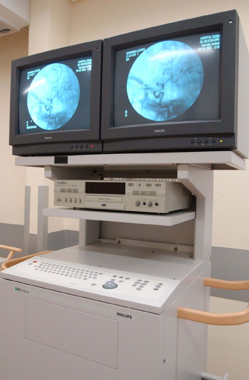 Aparelho de radiologia vascular: exame detecta obstrução em veias humanas | Antonio Costa/Gazeta do Povo