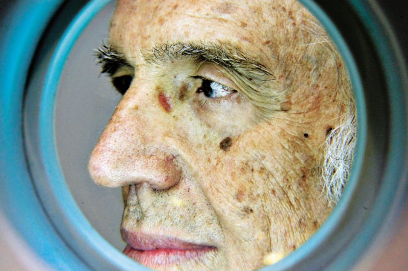 João Grimberg, 81anos, faz avaliações periódicas na pele para prevenir marcas e doenças | Marcelo Elias/ Gazeta do Povo