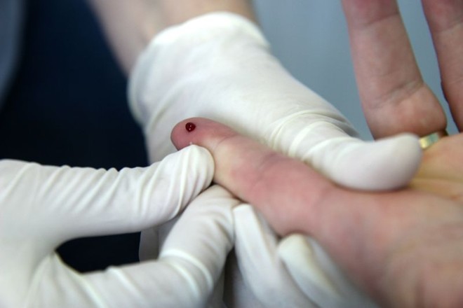 No bairro São Francisco, em Curitiba, hoje tem testes rápidos de HIV. O exame é gratuito | 