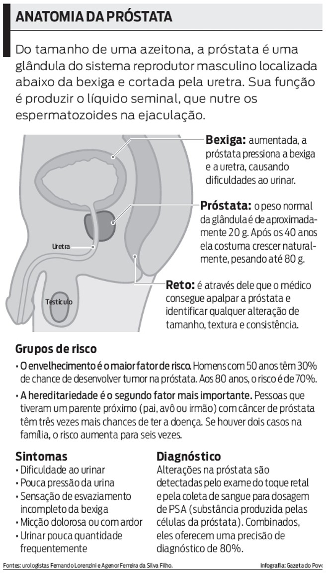 Veja a anatomia da próstata |