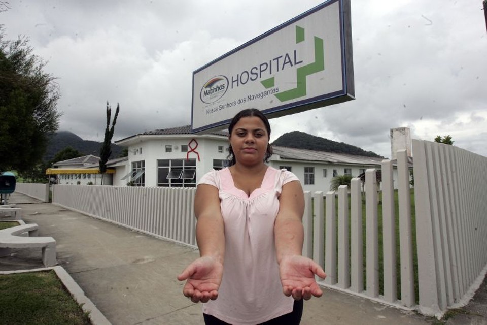 A estudante Jaqueline Oliveira dos Santos percebeu as manchas vermelhas na pele no segundo dia em que estava na praia | Hedeson Alves / Gazeta do Povo