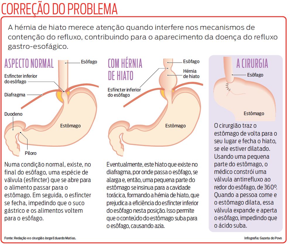 Veja como é feita a correção do problema |