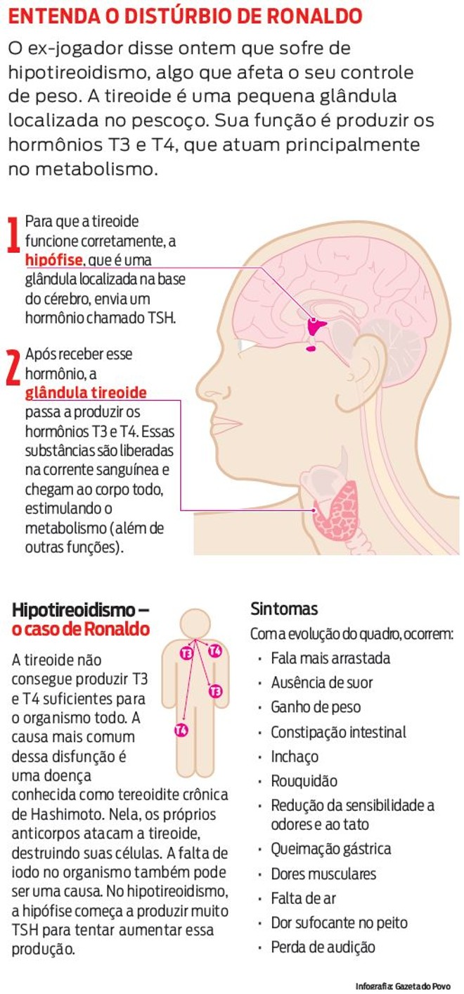 Entenda o distúrbio de Ronaldo |